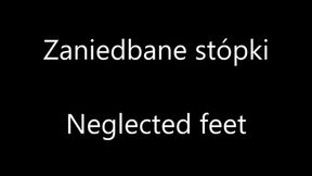 Neglected Feet