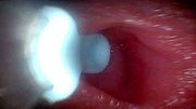 I couldn’t believe what happens INSIDE the penis as sperm passes through (endoscopic footage)