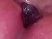 Urethral Examination