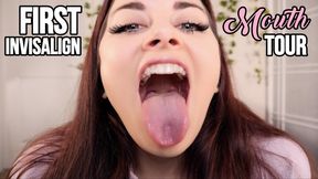 FIRST INVISALIGN MOUTH TOUR 4K - ELLIE IDOL