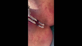 Guy Pee inside My Pussy with Speculum on the Beach