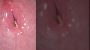 Playing With Zoom levels