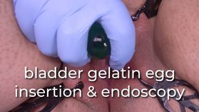 bladder gelatin egg insertion & endoscopy