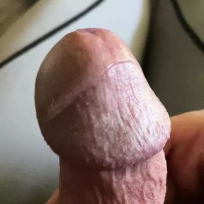 My beautiful MUSHROOMDICK up close !