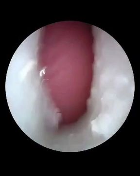 Inside a deflowered 18+ year old hairy cunt.