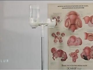 Gyno climax