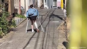 とある男の忘備録　かわいそう骨折ちび