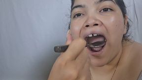 Inspection of yellow teeth