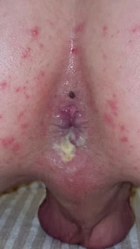 Blonde Twunk Creampies Submissive Twink Bottom As They Both Cum At The Same Time