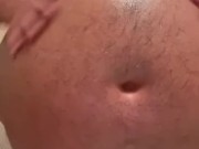 Sunburn