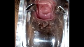 SLIM INDIAN BROWN GIRL CERVIX SPECULUM CHECK VAGINAL OPENING