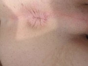 Twink perineum sunning asshole while neighbours can see