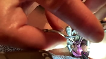 Push/pull of two ruthless instruments w cervix play