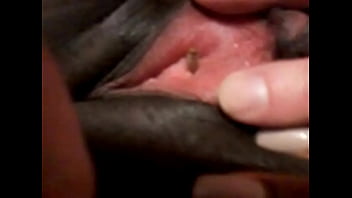 Maggot entering black woman&#039_s urethra!