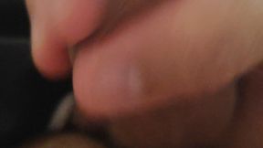 Immense Phimosis Being Extracted Cum and Précum.