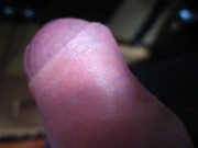 mon prépuce