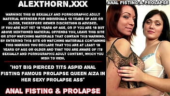 Hot big pierced tits Aspid anal fisting famous prolapse queen Aiza in her sexy prolapse ass