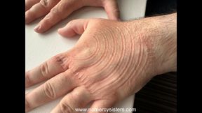 Arm and hand trampling