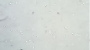 Soi tinh tr&ugrave_ng ch&uacute_ bộ đội