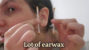 Ear Wax Removal Tease: Softening Liquid, Cotton Swab Dig & Ear Stretching Scratch Close-Up