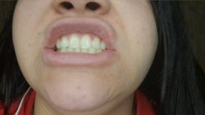 Dirty Smile: Yellow Teeth Exposed