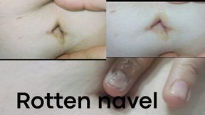 Cleaning my rotten belly button