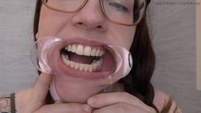Glasses and Gape: 11-min Dental Speculum-stretched Drool Session