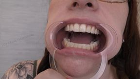 Glasses and Gape: 11-min Dental Speculum-stretched Drool Session