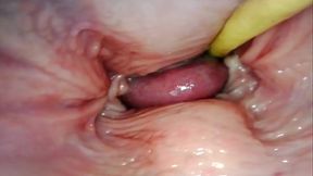 AMAZING INTERNAL POV  CAMERA INSIDE HER PUSSY WHILE I FILL HER WITH CUM