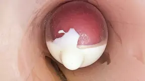 The Camera in the Deep Pussy Records a Huge Ejaculation of Sperm Into the Condom