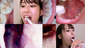 Mino ri Mashiro - Observing Mino ri's teeth, mouth, and back of the throat with a dental camera
