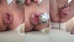 i jerking my sprained prolapse and show my rose from which a natural lubricant flows out.i also cum with help my huge tattooed cuck!