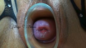 This Is What My Cervix Looks Like After a Year Without Seeing It