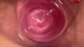 Camera Deep Inside Mia's Vagina