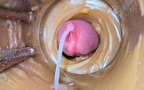 Camera Inside Deep Captures Huge Ejaculation of Sperm 2 Times