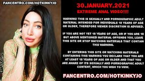 XO speculum &amp_ huge dildo from JohnThomasToys in Hotkinkyjo prolapse anal hole