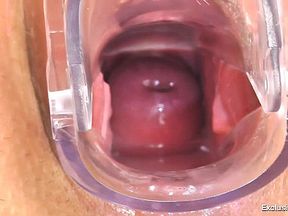 Jennifer Amton Comes To Her Gyno Doctor