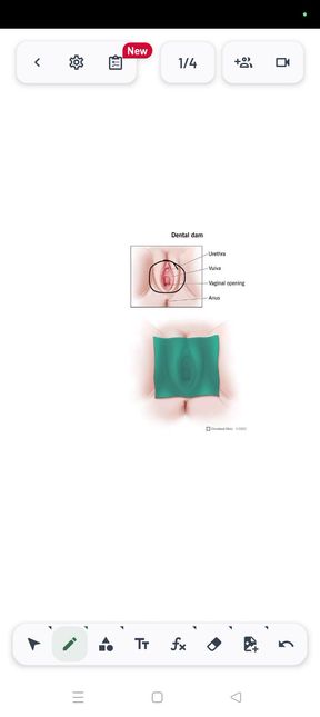How to Use a Dental Dam