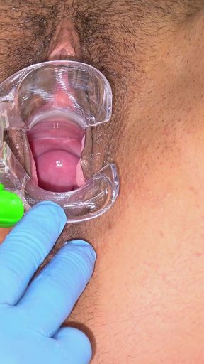 Hairy Pussy of Hot MILF Trinity Black Examined with Speculum