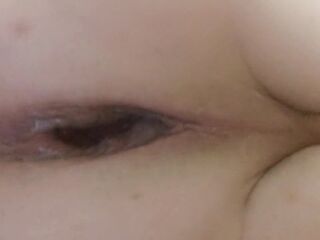 Trans woman Alice Rose shows u her ruined arsehole