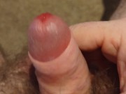 Smegma Requested Video 🦴🧀
