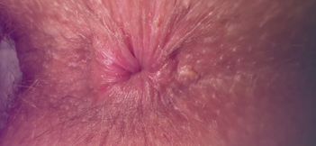 GREATEST BUTTHOLE LOOKS YOU EVER SEEN