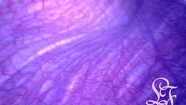 Extreme Pressure inside POV of my Bladder and Urethra