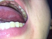 Mouth exam in front of the camera (Short version)