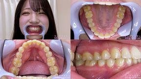 Sara Issiki - Watching Inside mouth of Japanese cute girl - MOV 1080p