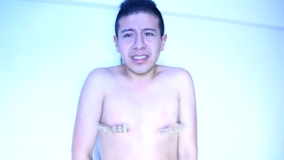 Pinzas en los pezones