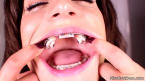 Inside her mouth: Braces cuttie