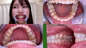 Satomi Mioka - Watching Inside mouth of Japanese cute girl - 1080p