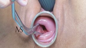 MASTURBATION OF MY OPEN-MOUTHED CERVIX 4k