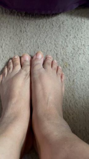 Dry feet in need of some love